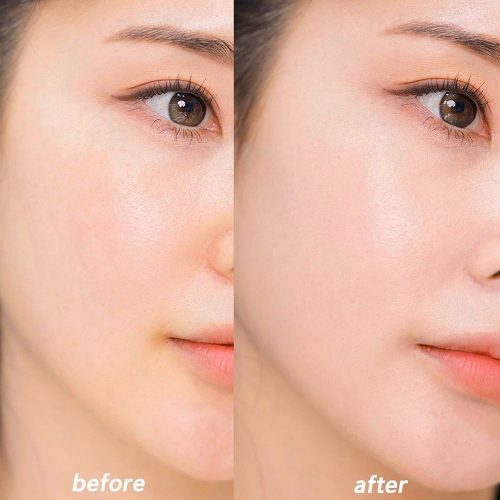 Perfect Skin Tone