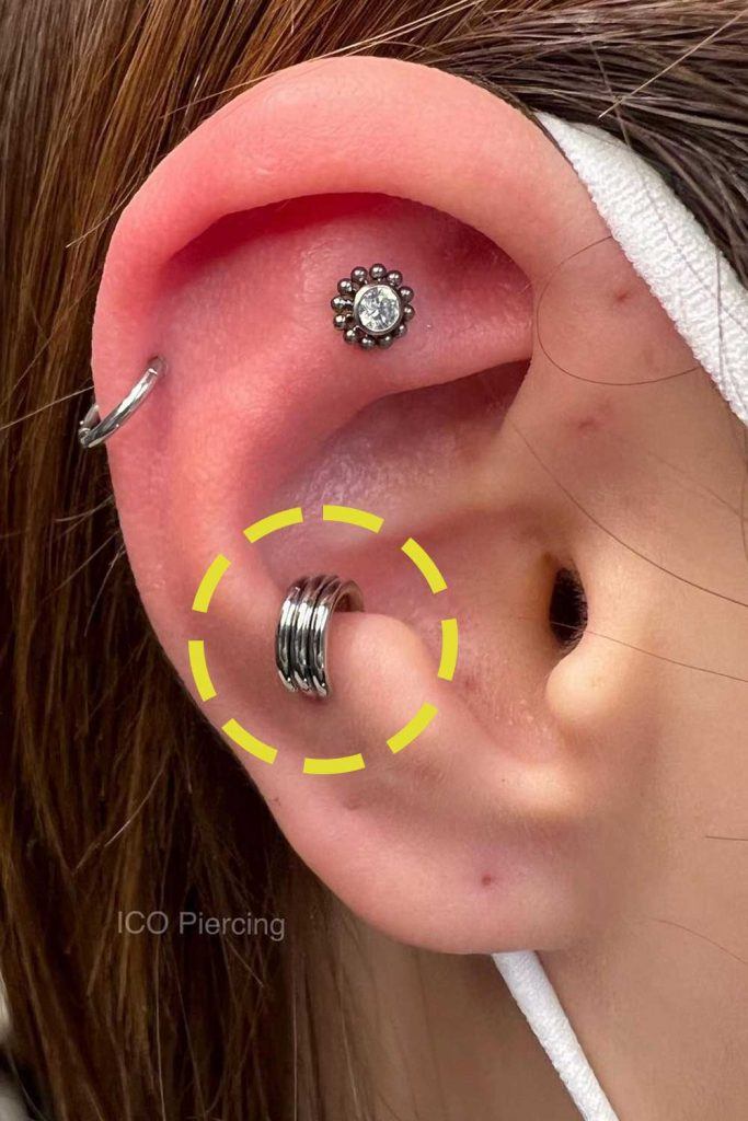 Anti-Tragus Piercing